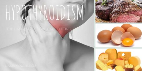 Hypothyroidism
