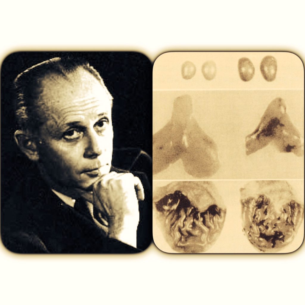 This Depicts Dr. Hans Seleye next to images of the triad condition which can be produced by over exposure to any stress.  The symptoms were  A) the enlargement of the adrenal gland  B) the shrinking of the Thymus,  C) the ulceration of the upper gastrointestinal tract.